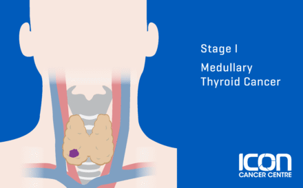 Stage 1 medullary thyroid cancer