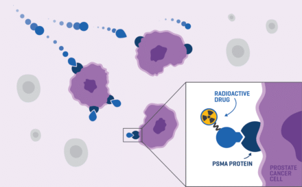Step 2 PSMA Diagnostics